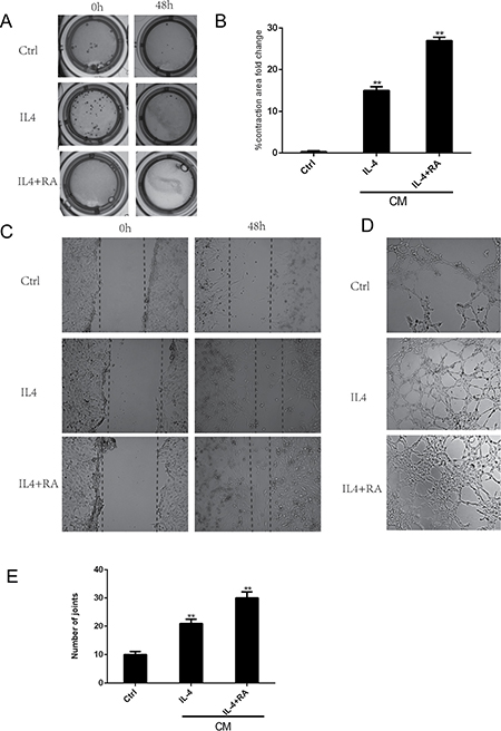 RA enhanced macrophage-dependent stromal cell activation and angiogenesis.