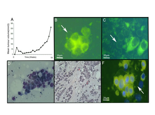 Giant vesicles are produced in xenograft and primary breast tumours.