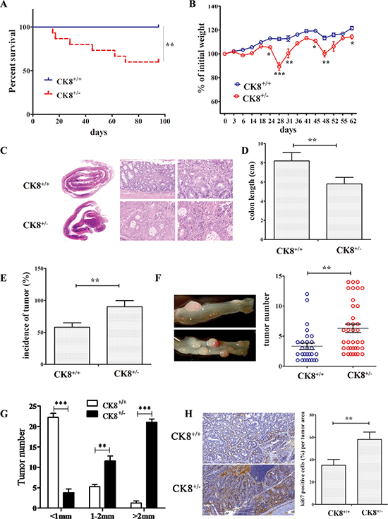 Knockdown of CK8 promotes susceptibility to AOM/DSS-induced colitis-associated colorectal carcinoma.