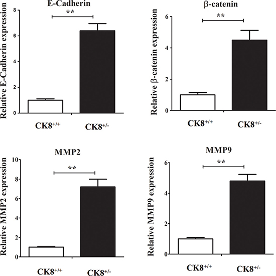 Cancer-related genes mRNA expression in colons of CK8+/+ mice and CK8+/&#x2212; mice with colorectal cancer.