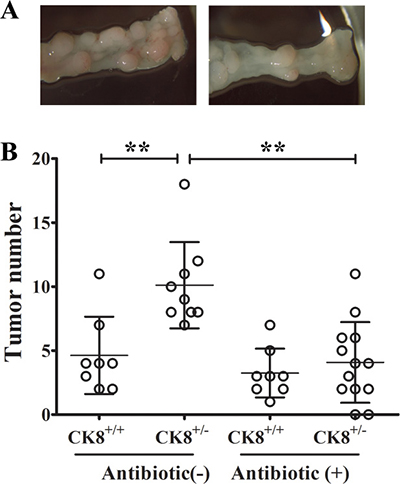 Intestinal depletion of bacteria reduces tumor formation in CK8+/&#x2212; mice.