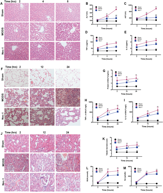 Nec-1 treatment significantly reduced necroptosis-induced multiorgan injury and dysfunction.