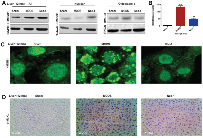 Nec-1 inhibits HMGB1 release and MLKL pseudokinase in rats with MODS.