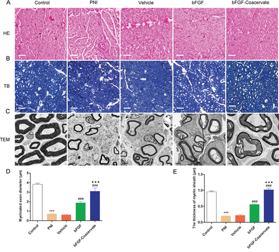 Histological investigation and morphometric analysis at 30 days after crush injury.