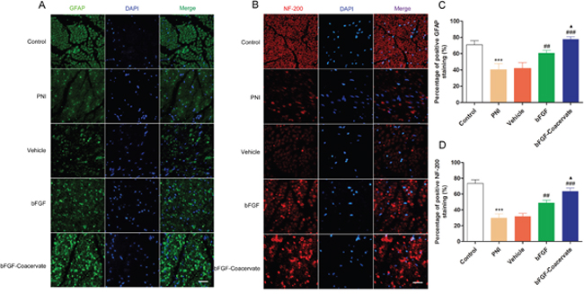 Evaluation of neurofilament-stained axonal growth and GFAP-positive SC proliferation in each group at 30 days post-injury.