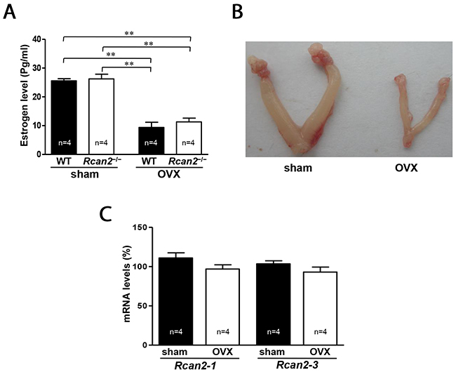 Serum levels of estradiol and expression of Rcan2 mRNA in OVX mice.