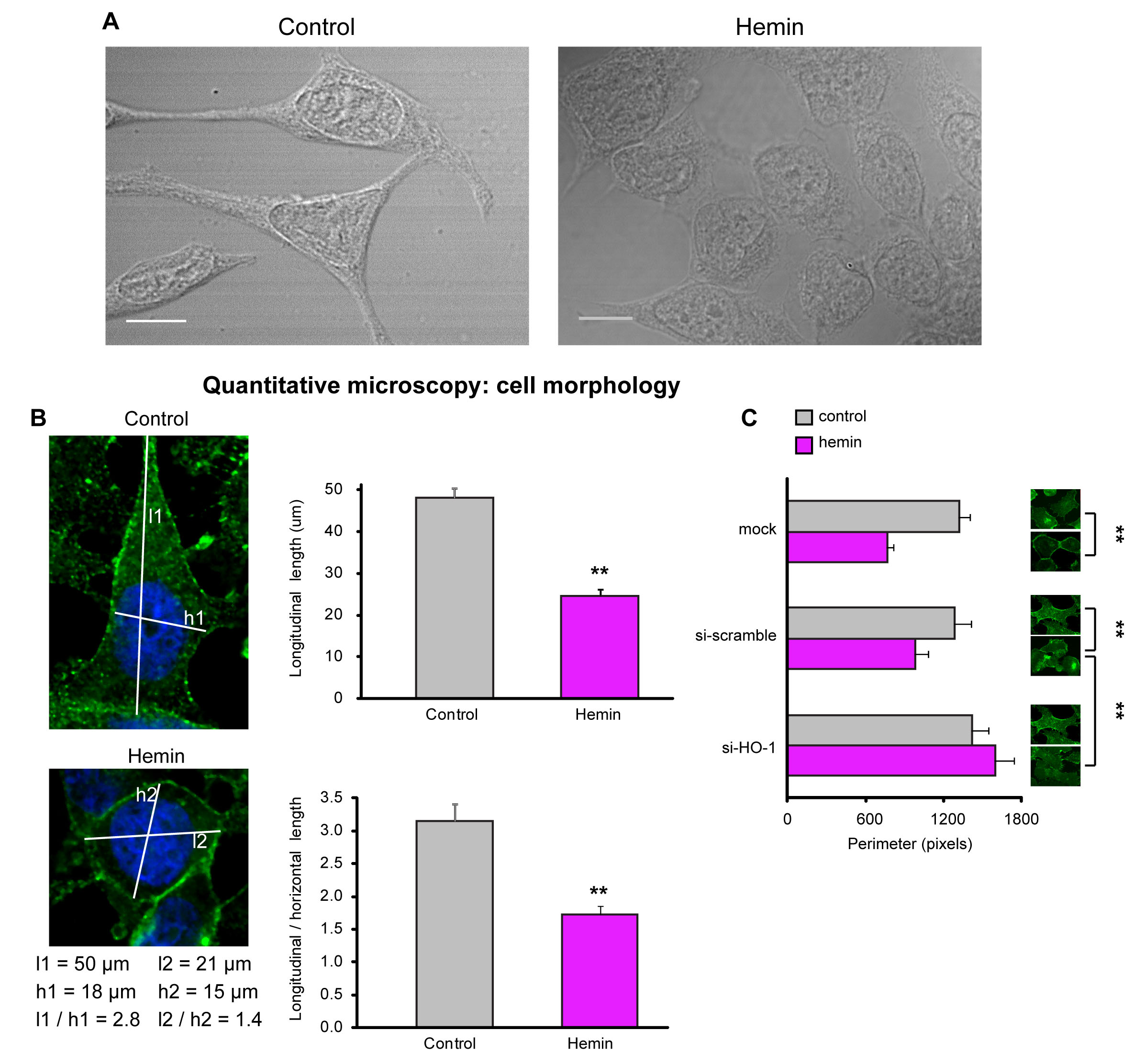 FIGURE 6: HO-1 is implicated in cell morphology regulation.