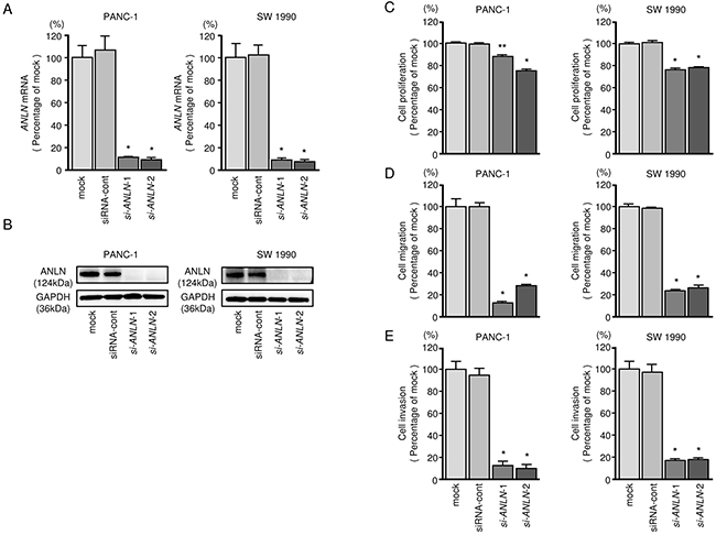 ANLN mRNA and ANLN protein expression after si-ANLN transfection and effects of ANLN silencing in PDAC cell lines.