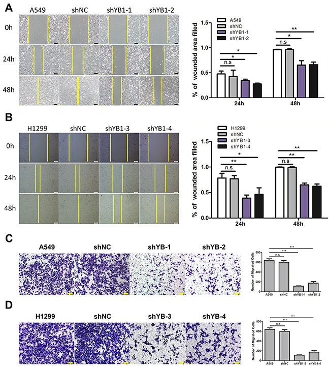 Inhibition of YB-1suppresses migration of lung adenocarcinoma cells.