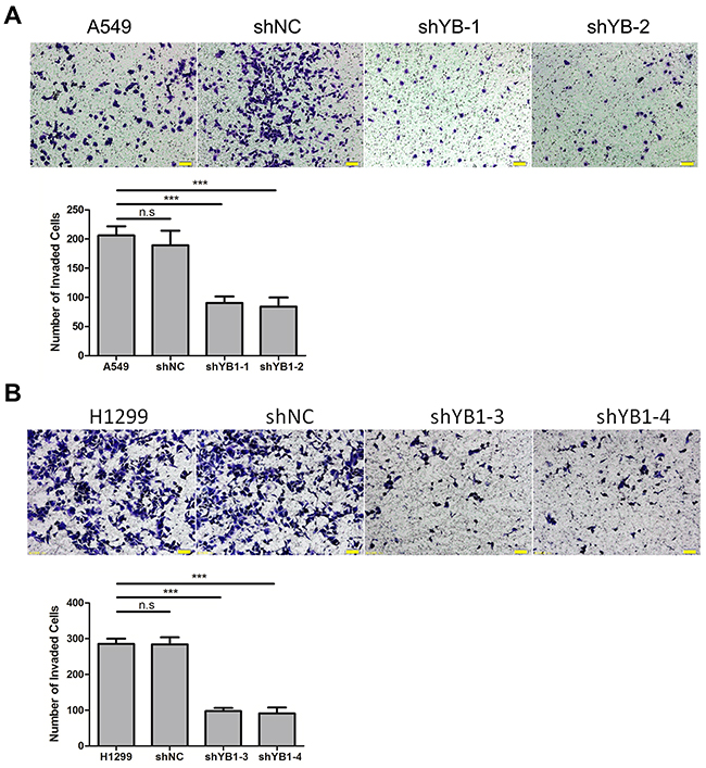 Inhibition of YB-1 suppresses invasion of lung adenocarcinoma cells.