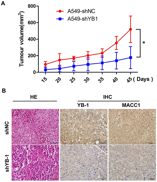 Inhibition of YB-1 suppresses tumor growth in a lung adenocarcinoma xenograft mice model in vivo.