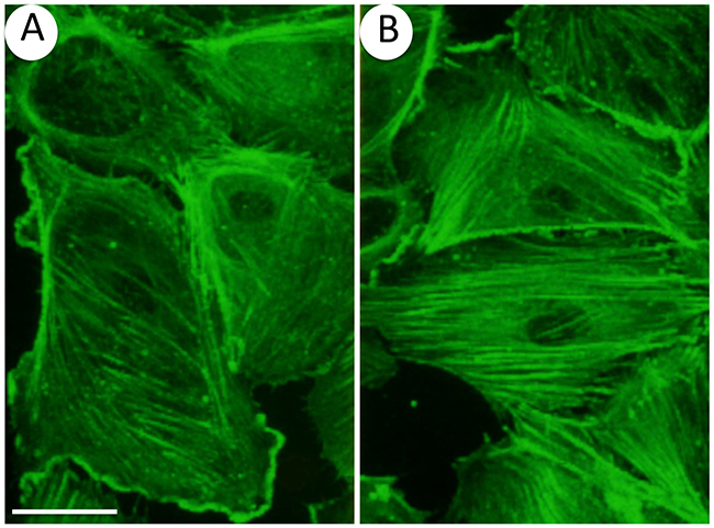 Oxidative stress induces actin remodeling in endothelial cells.