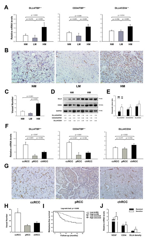 Clinical association of DLL4 with the hematogenous metastasis of RCC.