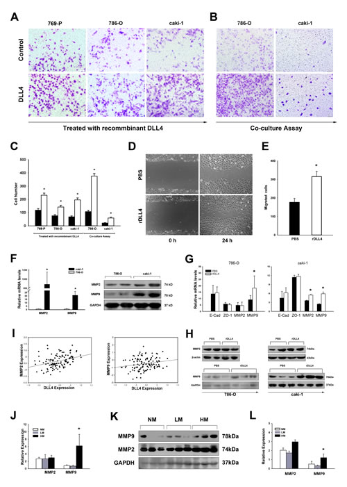 Endothelial DLL4 promotes RCC cell migration and invasion by stimulating MMP secretion.