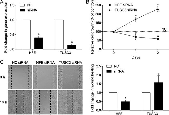 Effect of down-regulated HFE and TUSC3 expression on prostate cancer cell growth and migration.