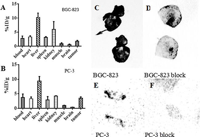 Biodistribution of 64Cu-PSMA-617 in tumor-bearing mice and the auto-radiography images of tumor tissues.
