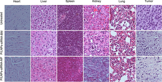 Histopathology of tissue sections stained with hematoxylin/eosin (H&#x0026;E).