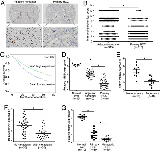 Barx1 is significantly down-regulated in human HCC tissues and low expression of Barx1 indicates poor prognosis.