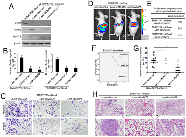 Barx1 inhibits HCC metastasis through the inhibition of MGAT5 and MMP9 expression.