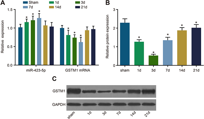 Analysis of miR-423-5p and GSTM1 levels in sham and I/R rat kidneys.
