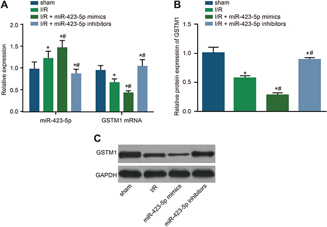 Effects of miR-423-5p mimics and inhibitors on GSTM1 expression in I/R treated rat kidneys.