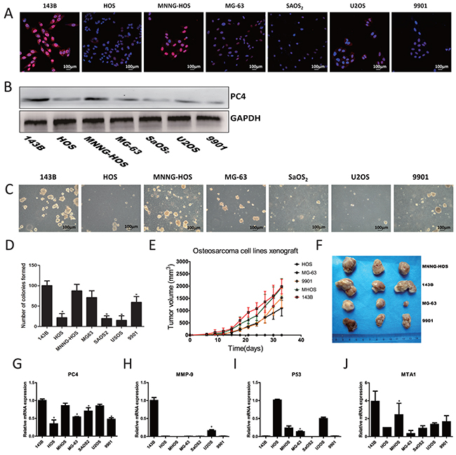 Expression of PC4 in osteosarcoma cells and malignant phenotype of different osteosarcoma cell lines.