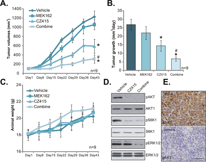 The anti-OS activity of CZ415 in vivo.