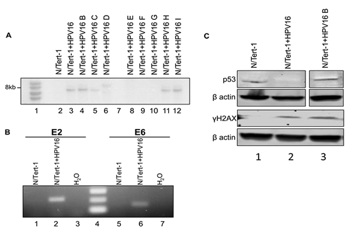 N/Tert-1+HPV16