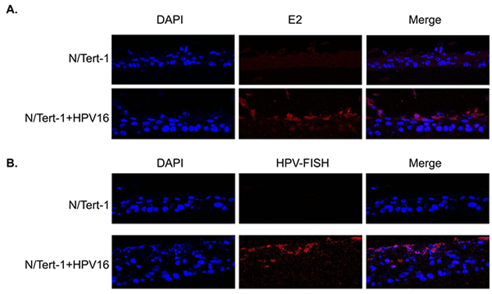 HPV16