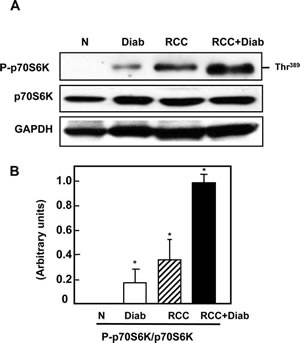 Fig 3: Hyperactivation of mTOR in kidney cancer patients with diabetes.