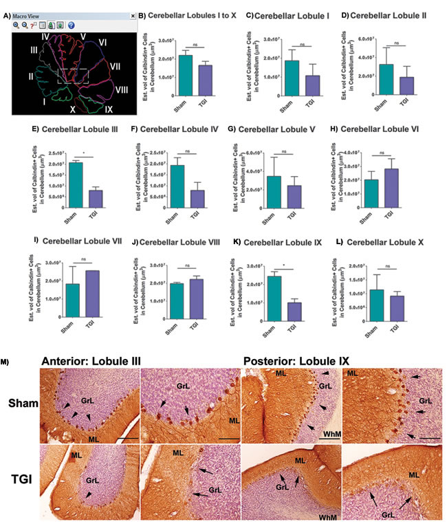 Increased Purkinje cell loss in cerebellar lobules after TGI.