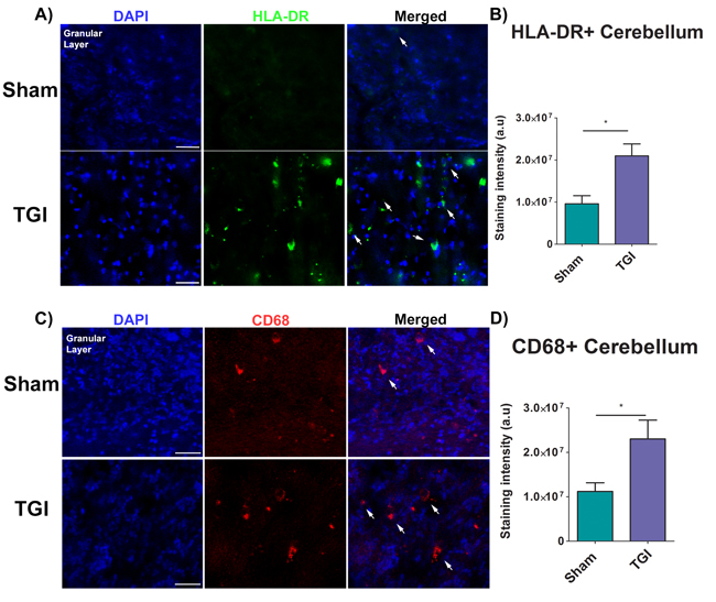 Increased expression of inflammatory markers in the granular cell layer of the cerebellum after TGI.