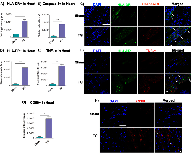 Increased expression of HLA-DR, caspase 3, TNF-&#x3b1; and CD68 in the heart after TGI.