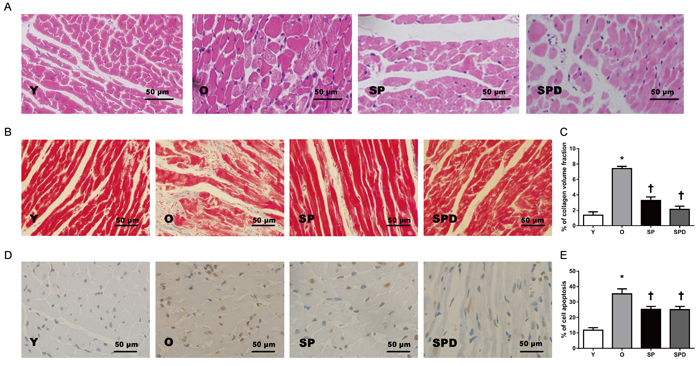 Myocardial histology and morphology in young (Y), old (O), spermine (SP)-, and spermidine (SPD)-treated rats.