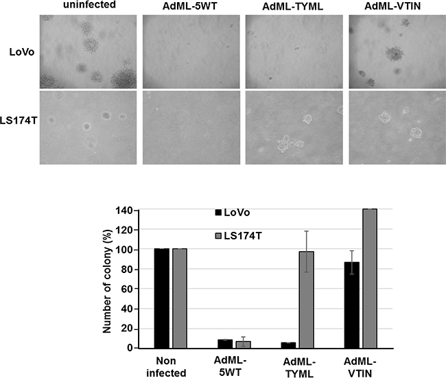 Effect of AdML-TYML in tumorigenic potential of Cancer Stem Cells.