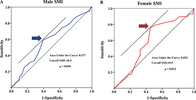 Receiver operating characteristic (ROC) curve of low muscle mass for both sexes.