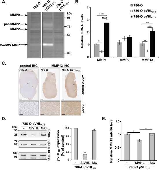 pVHL172 promotes MMP13 upregulation.