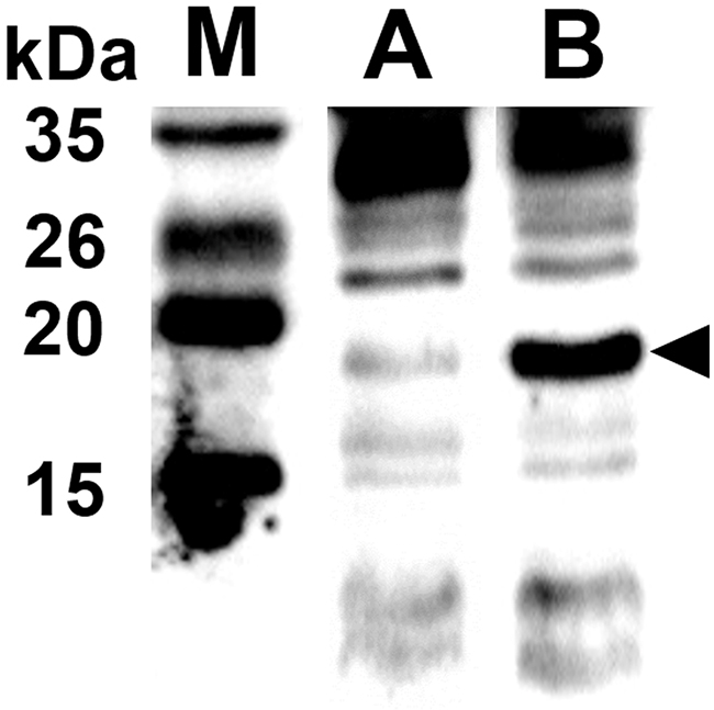 Endolysin and protein E expressed in JOL1675 confirmed by rabbit anti-endolysin polyclonal antibodies.