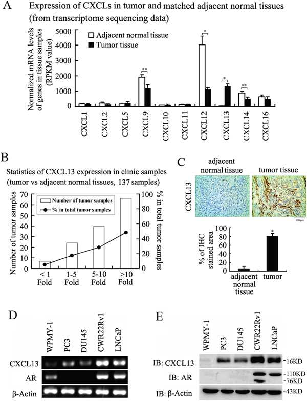 Expression of CXCL13 in PCa tissues and cell lines.