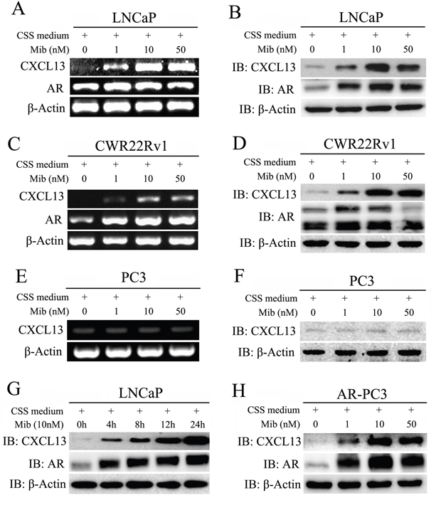 Androgen stimulation enhanced expression of CXCL13 in AR expressed PCa cells.