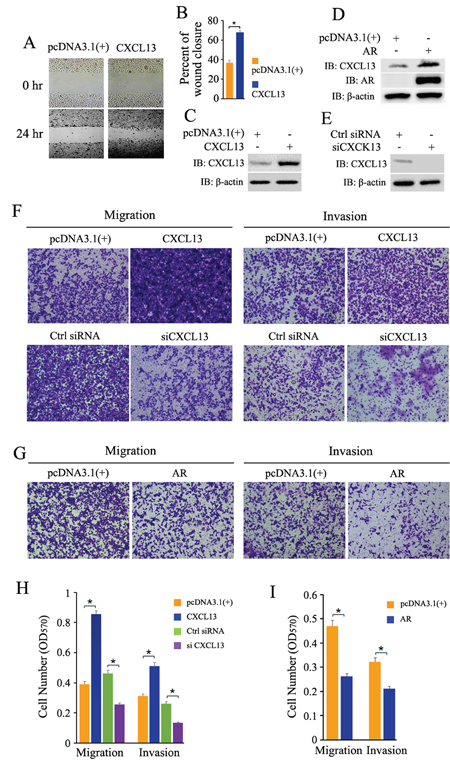 Effect of CXCL13 on cell migration and invasion in androgen-independent PCa cells with or without recovery expression of AR.