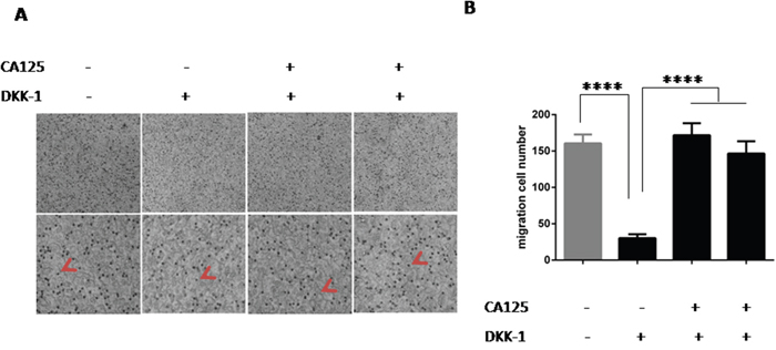 CA125 reverses the effect Wnt pathway inhibition on cancer cell migration.