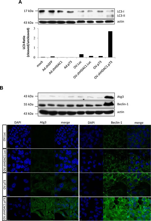 Induction of authophagy after infection with OVs.