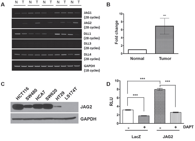 JAG2 expression in intestinal tumors of ApcMin/+ mice and human CRC cell lines.