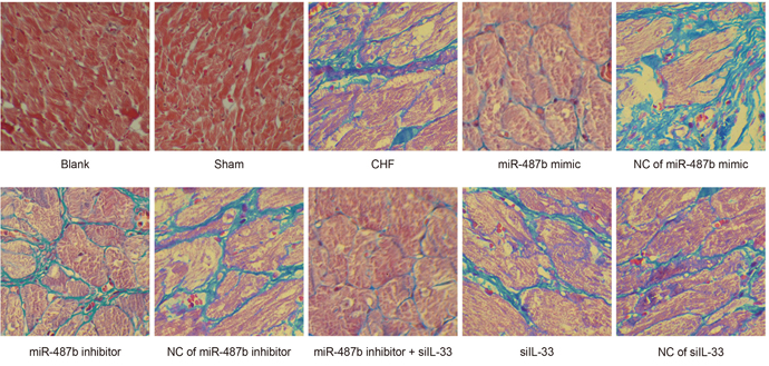 The myocardial tissues of rats detected by Masson staining among eight groups (&#x00D7; 200).