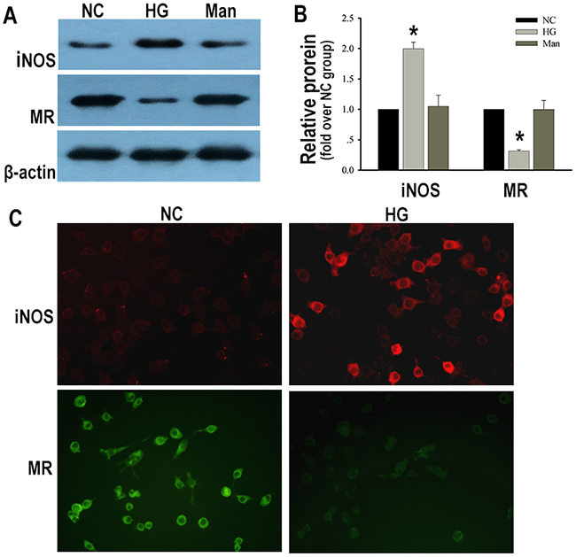 Macrophages displayed pro-inflammatory M1 activation under high glucose condition.