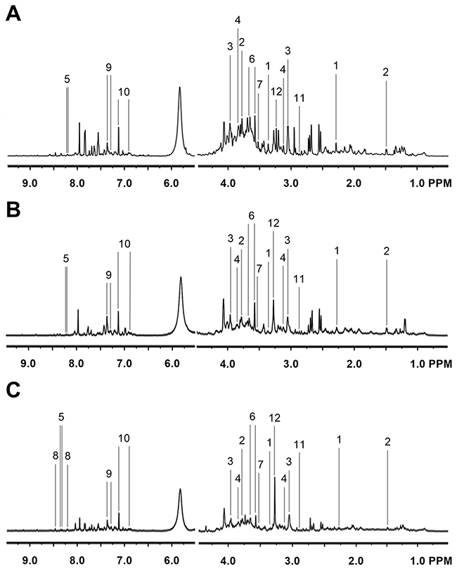 Representative 1H NMR Spectra from Primary HCC Tumors.