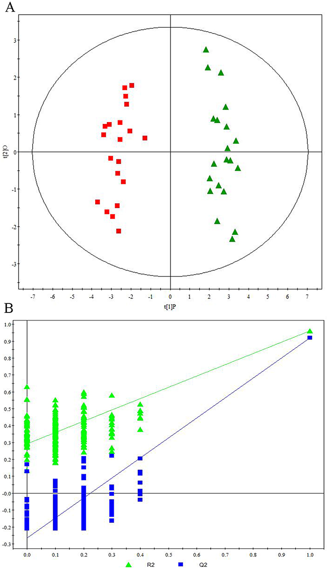 Metabonomic Analysis Differentiating Primary HCC Tumors from ALD Patients and HCV-Infected Patients.