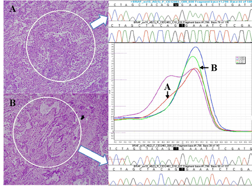 Fig 1: Photomicrographs of the cored areas marked with a dotted circle.