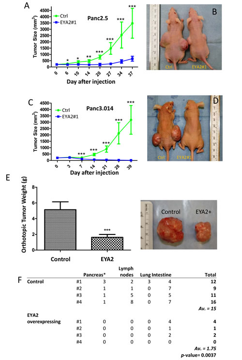 (A-D) Panc2.5 and Panc3.014 control and EYA2-overexpressing cells were used to perform subcutaneous xenografts in Nude mice.